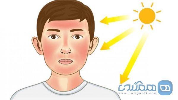 کارهایی که پس از آفتاب سوختگی نباید انجام داد